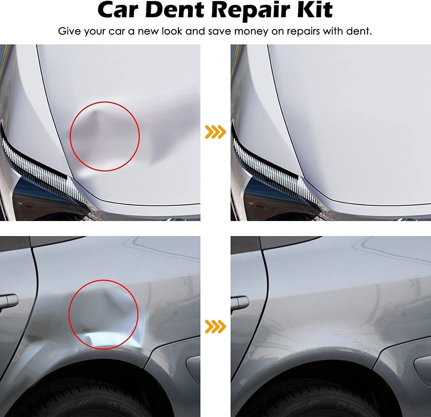DentFix - Suction Dent Remover