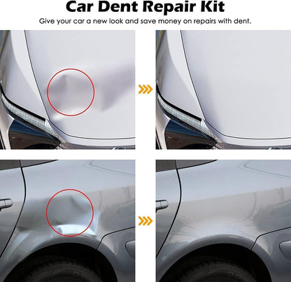 DentFix - Suction Dent Remover