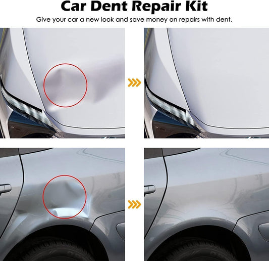 DentFix - Suction Dent Remover